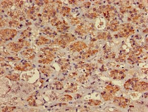 Polyclonal Rabbit anti-Human MYO7A / Myosin-VIIa Antibody (IHC, IF)