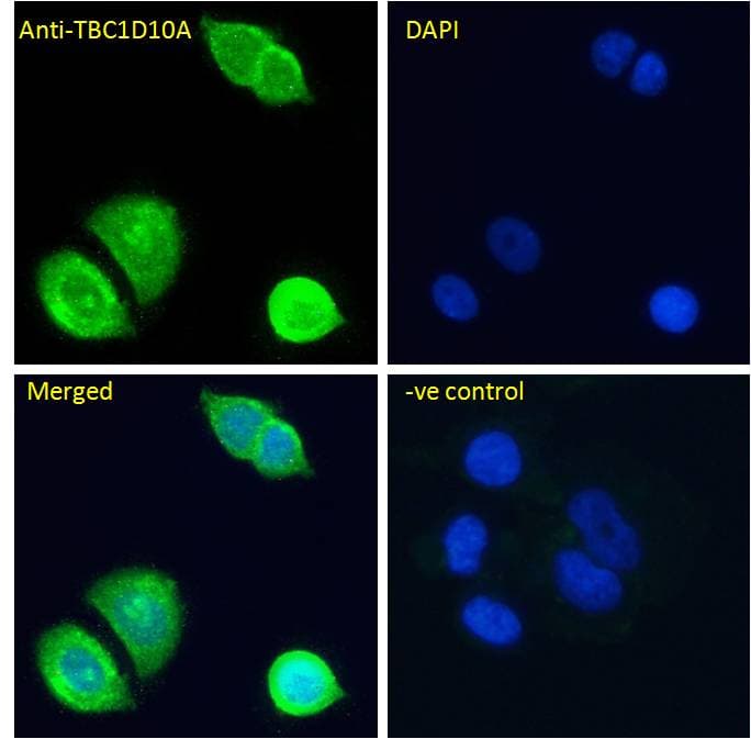 IHC-plus™ TBC1D10A Antibody (aa2-14)