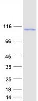 Human KIF6 Protein (Recombinant Myc-DDK (Flag))