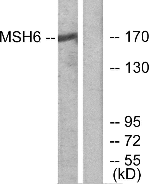 Polyclonal Rabbit anti-Human MSH6 Antibody (WB)