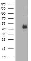 TGFB1 / TGF Beta 1 Antibody (clone OTI3B6)
