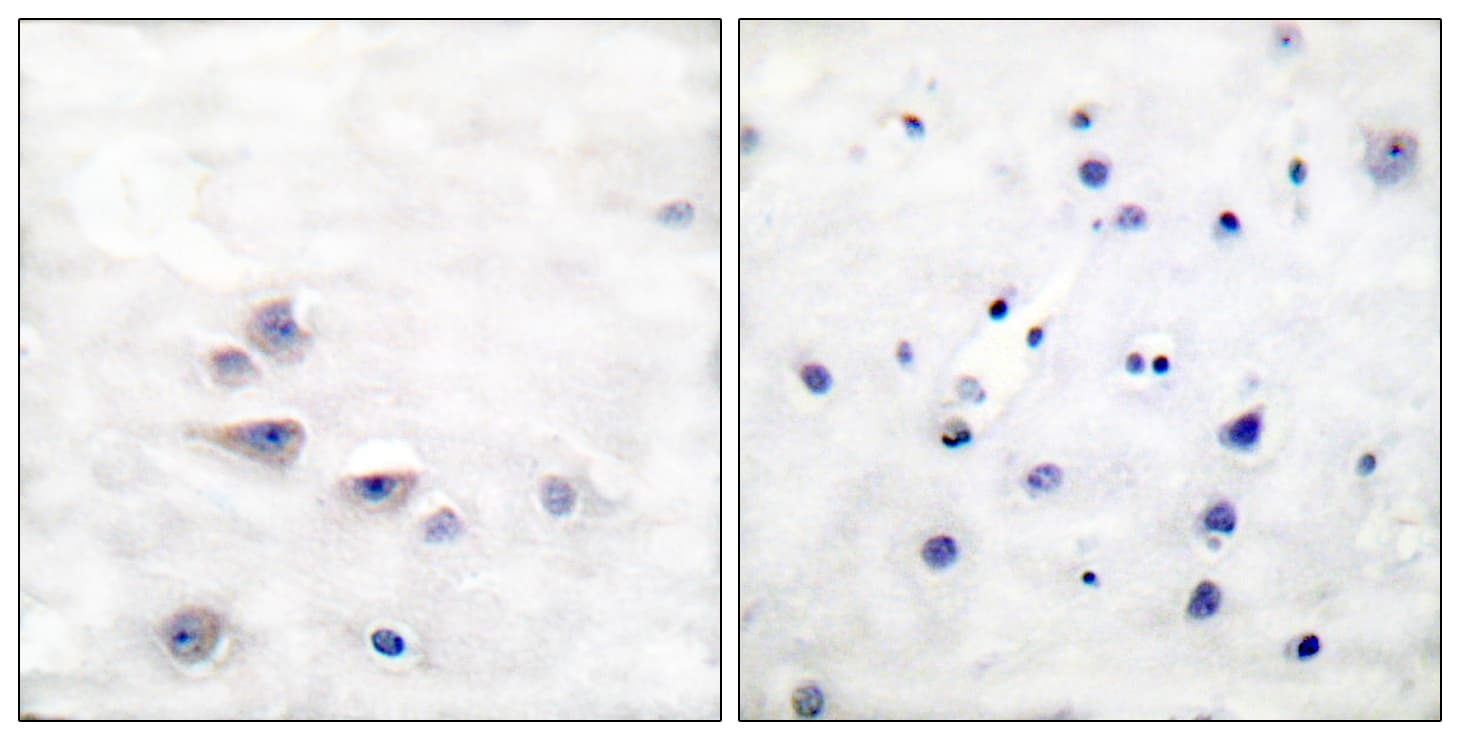 p66 / SHC Antibody (phospho-Tyr427)