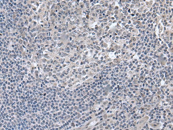 Polyclonal Rabbit anti-Human EDARADD Antibody (IHC)