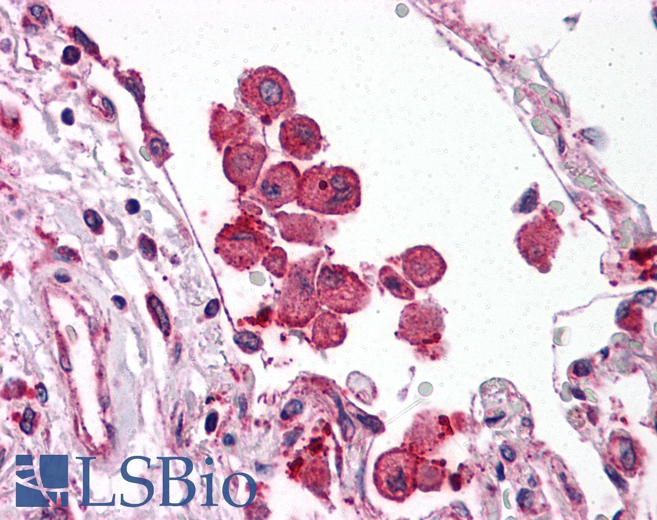Polyclonal Rabbit anti-Human TLR8 Antibody (IHC)
