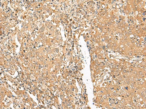 GOLGA6A Antibody
