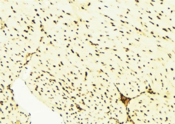 BAG1 / BAG-1 Antibody