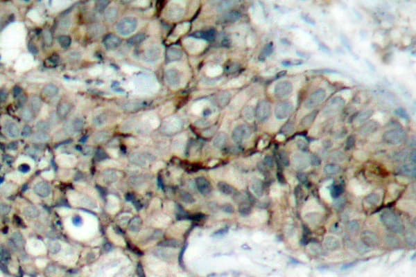 ITGB3 / Integrin Beta 3 / CD61 Antibody (phospho-Tyr773)