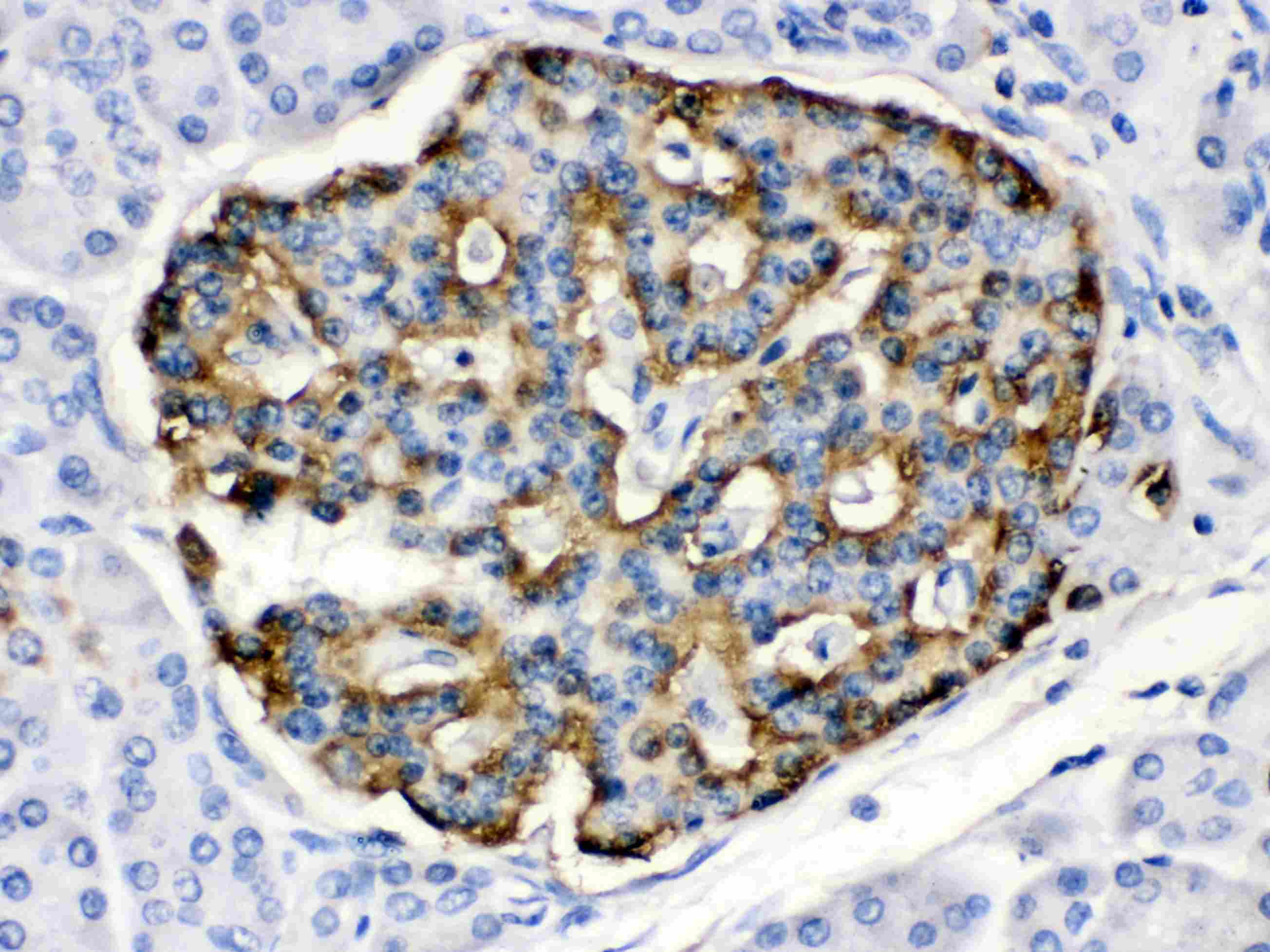 APOBEC3G / CEM15 Antibody