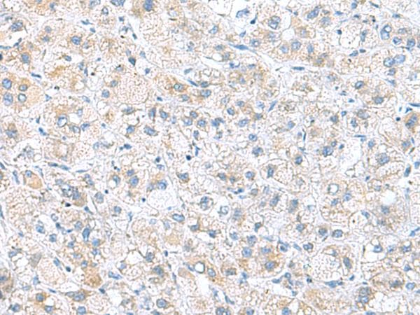 DNAL1 Antibody