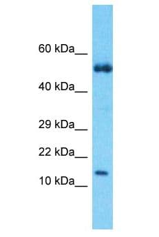 S100A9 / MRP14 Antibody (aa44-93)