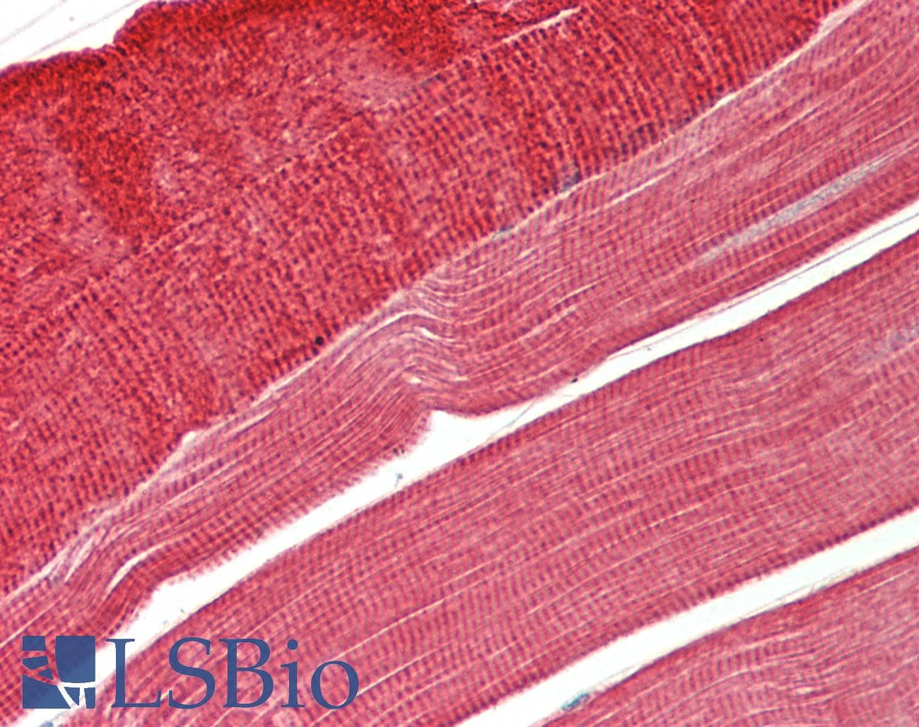 IHC-plus™ TPM3 Antibody