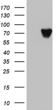 HNRPM / HNRNPM Antibody (aa1-261, clone OTI6H7)