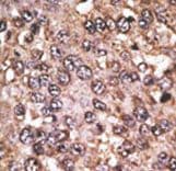 Polyclonal Rabbit anti-Human SIRT5 / Sirtuin 5 Antibody (aa263-292, IHC, WB)