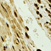 PSMA2 Antibody