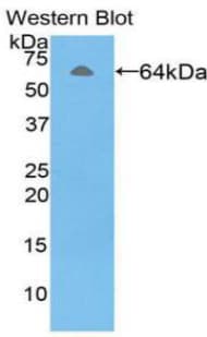 Alpha-Fetoprotein Antibody (aa31-576, APC)