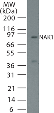 IHC-plus™ Polyclonal Rabbit anti-Human NR4A1 / NUR77 Antibody (aa251-266, IHC, IF, WB)