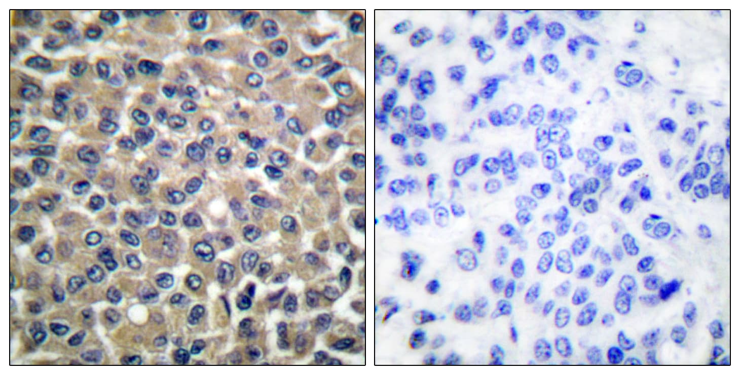 MMP19 Antibody (aa11-60)