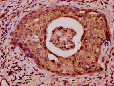 HIST1H3A Antibody