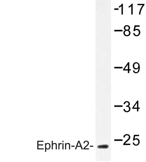EFNA2 / Ephrin A2 Antibody (Asn33)