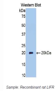 CD118 / LIF Receptor Alpha Antibody (aa642-791)
