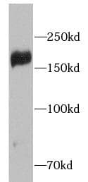 IRS2 / IRS-2 Antibody