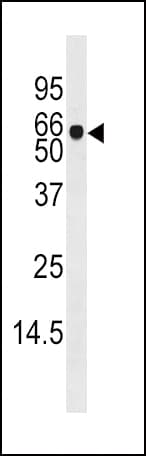 Polyclonal Rabbit anti-Human ADK / Adenosine Kinase Antibody (aa322-352, IHC, WB)