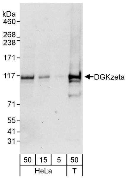 DGKZ Antibody (aa1067-1117)