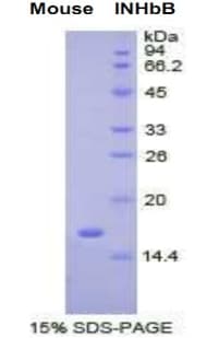 Mouse INHBB / Inhibin Beta B Protein (Recombinant His, N-terminus)