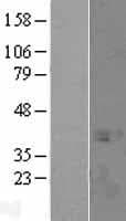 SPT3 / SUPT3H Protein (Over-Expression Lysate Myc-DDK (Flag))