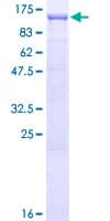 Human EVI5L Protein (Recombinant GST)
