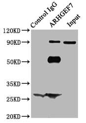 IHC-plus™ ARHGEF7 Antibody