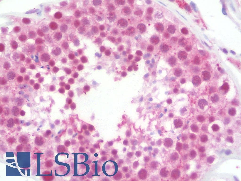 IHC-plus™ PRPF19 / PRP19 Antibody (aa171-220)