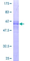 Human SUN1 Protein (Recombinant GST)