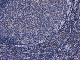 CAT / Catalase Antibody (clone OTI3C3)