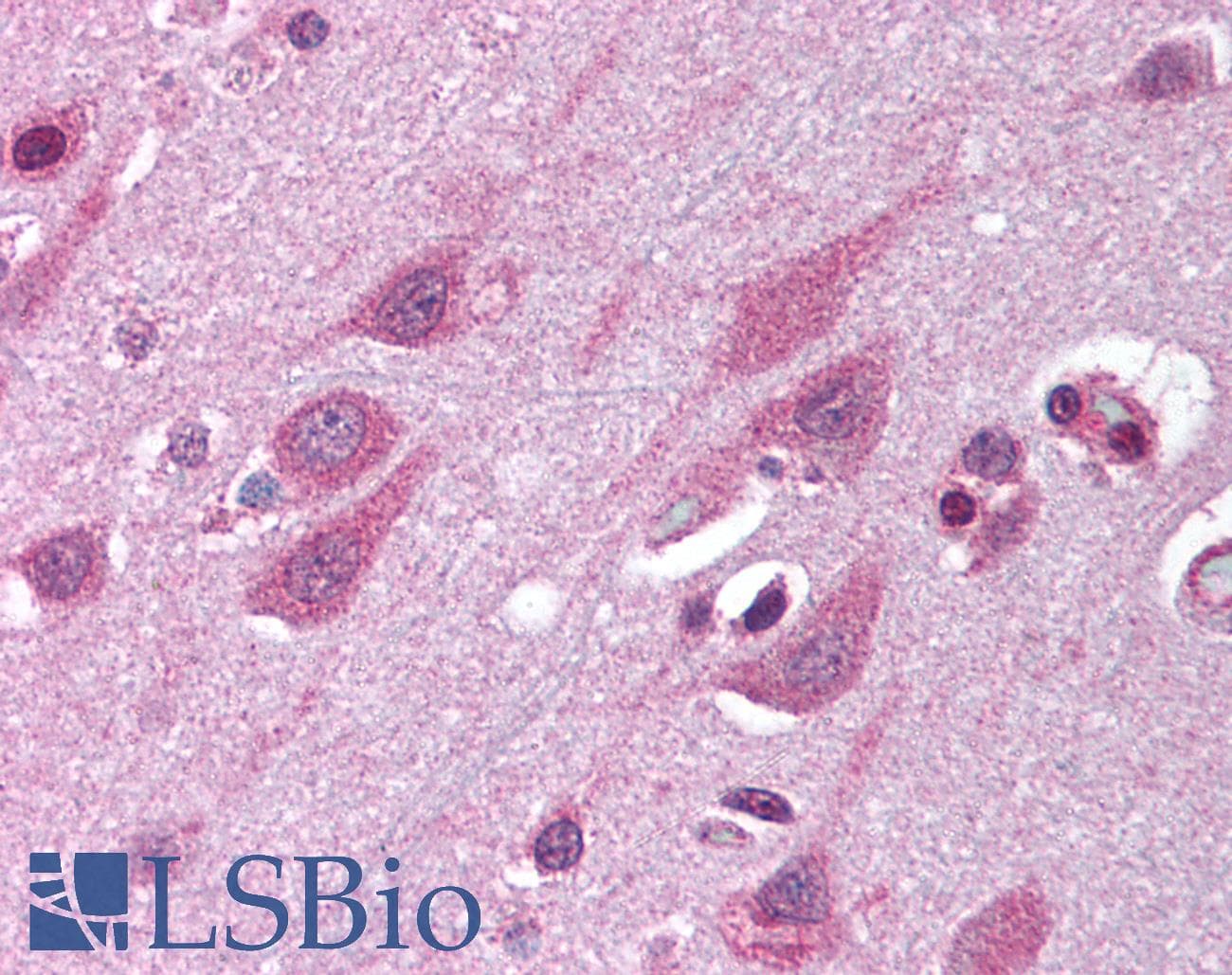 IHC-plus™ TMED10 / TMP21 Antibody