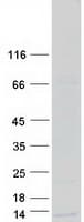 Human WFDC10A Protein (Recombinant Myc-DDK (Flag))