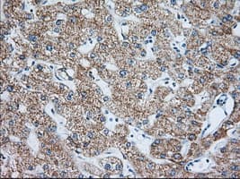 IGF2BP2 Antibody (clone OTI3F9)
