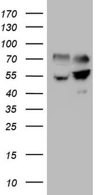 SHMT / SHMT2 Antibody (clone OTI1C1)