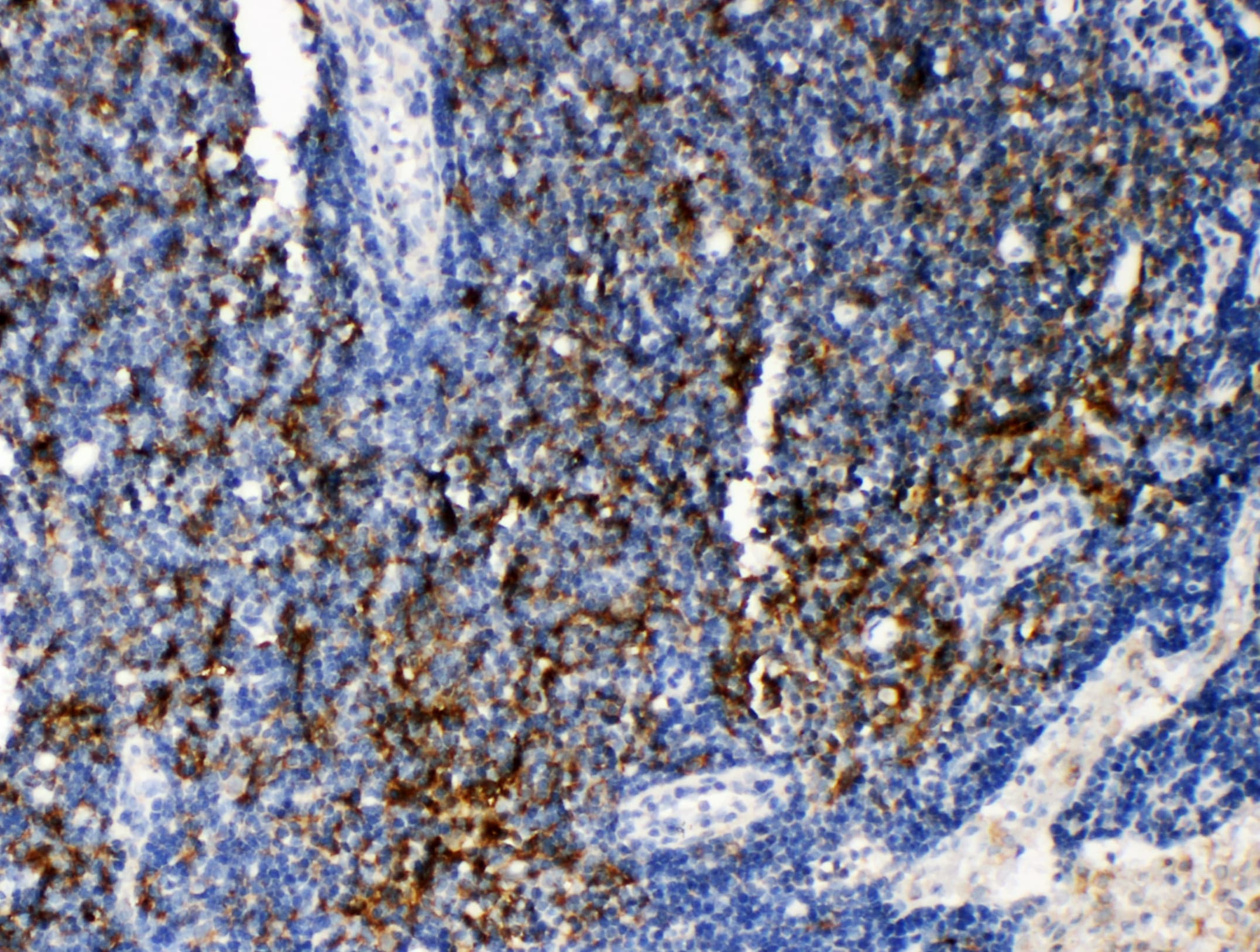 TRAF4 Antibody (aa437-454)