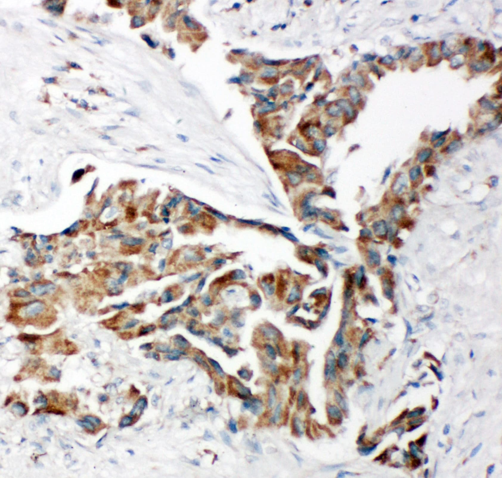 Polyclonal Rabbit anti-Human TRAM1 Antibody (aa314-331, IHC, WB)