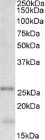 IHC-plus™ TPPP Antibody (aa21-35)