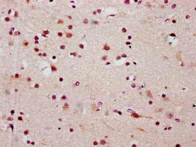 HIST1H2BN Antibody