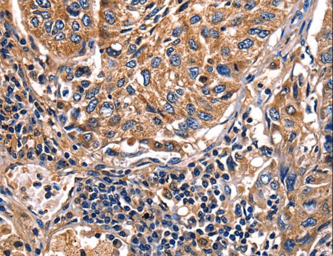 Polyclonal Rabbit anti-Human LGALS8 / Galectin 8 Antibody (IHC)