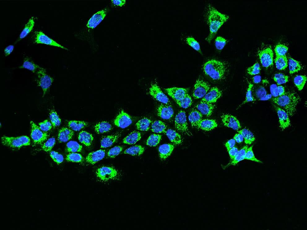 Polyclonal Rabbit anti-Human ETFB Antibody (IHC, IF, WB)