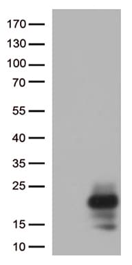 Monoclonal Mouse anti-Human MLANA / Melan-A Antibody (clone UMAB217, aa48-118, IHC, WB)