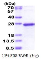 Human TGIF2LY Protein (Recombinant His)