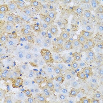 Polyclonal Rabbit anti-Human Apolipoprotein C-I Antibody (IHC, WB)