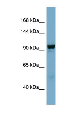 Polyclonal Rabbit anti-Human NDST4 Antibody (aa611-660, WB)