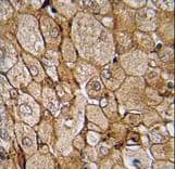 CAMK1G / CaMKI gamma Antibody (aa211-241)