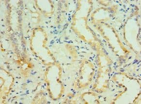 Polyclonal Rabbit anti-Human KCNN4 / KCa3.1 Antibody (aa288-427, IHC)